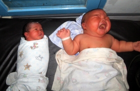 印尼41岁女子剖腹产8.7公斤巨婴(图)
