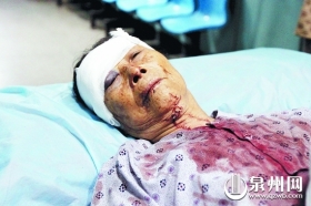 婆媳发生口角 75岁老太被儿媳砍破眼眶