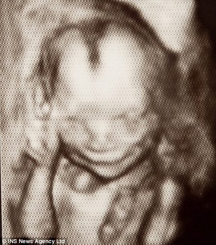 英国媒体公布胎儿在母亲腹中微笑照片(图)
