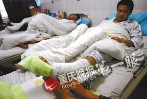 黄毅的左脚被砍断 记者 冉文 摄