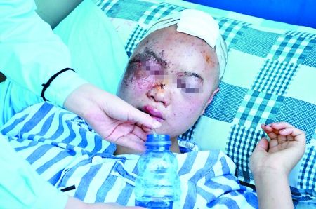 昨日，永川，反抗侵犯时被打伤的小妮在医院接受治疗。 记者 蒋雨龙摄