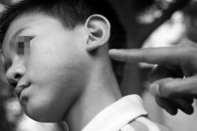 男童因遭同学投诉被老师连扇十余个耳光