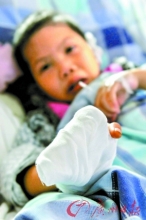 6岁女孩被养母砍掉四根手指和一只耳朵
