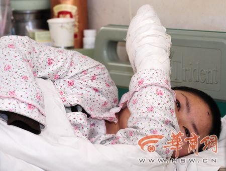 <a href=//sxi.110.com>陕西</a>22岁女孩拒绝与男友同居 被砍断手腕(图)