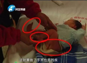女子产检1次不漏孩子出生3条腿 医院：检查不出